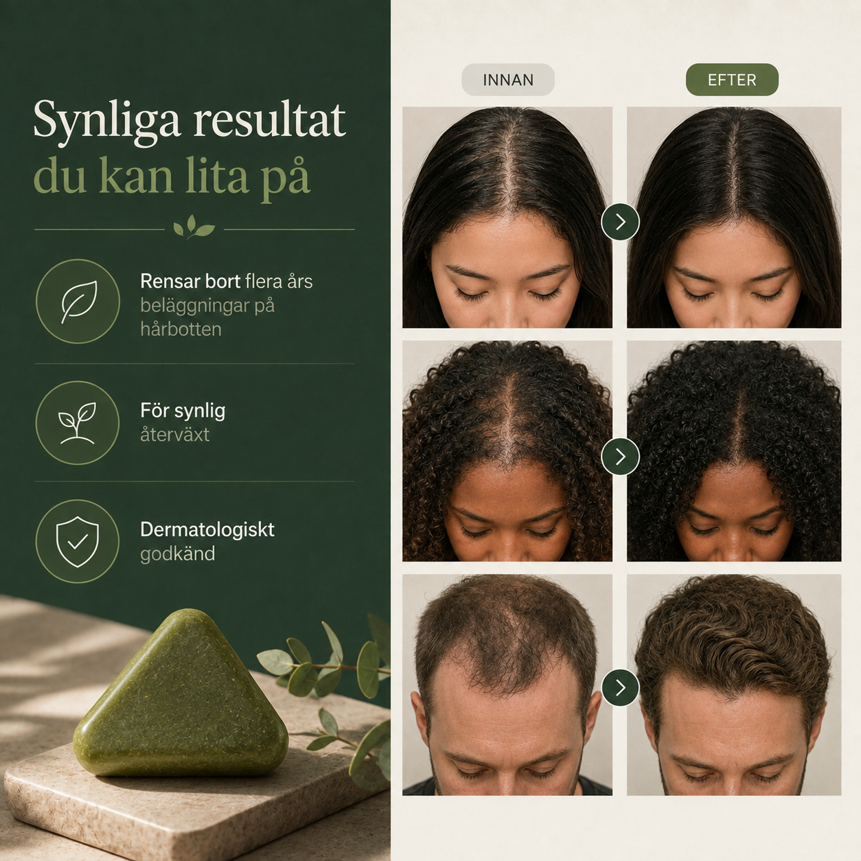 Luneo™ Koreansk Skalpkur